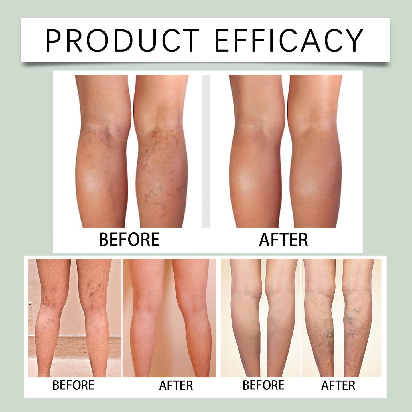 Body Care Leg Warmer Relieve Knee Discomfort